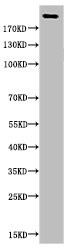 Anti-Acetyl-CREBBP (K1535)