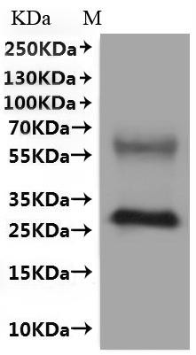 Olfactory receptor 51E2 (OR51E2)-VLPs, human, recombinant