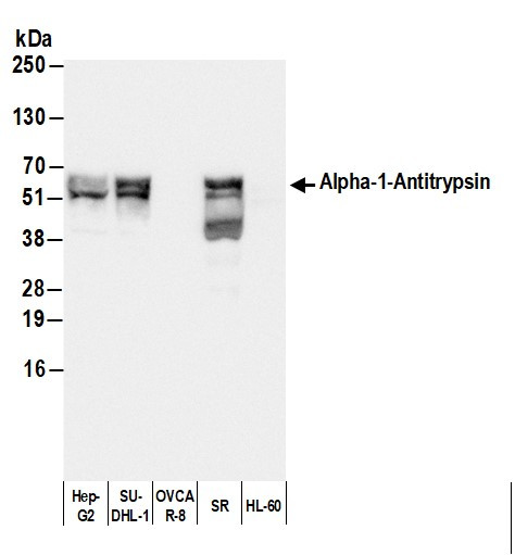Anti-Human Alpha-1-Antitrypsin