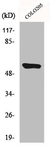 Anti-CYP4A11/CYP4A22