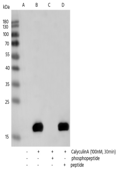 Anti-Phospho-Myosin Light Chain 2 (Thr18, Ser19) Monoclonal Recombinant Antibody