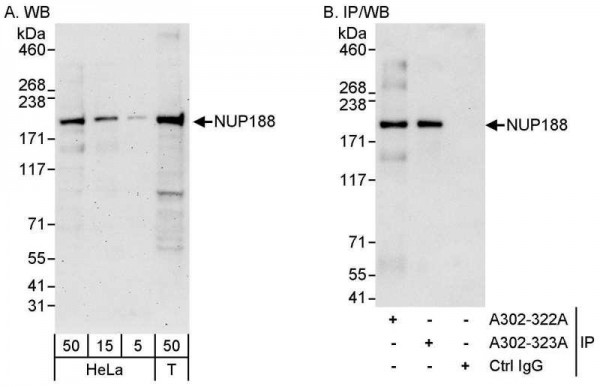 Anti-NUP188
