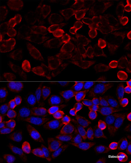 Anti-HDAC6