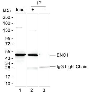 Anti-ENO1