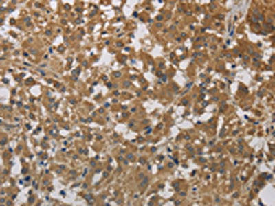 Anti-CYB5A