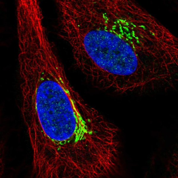 Anti-ARIH1