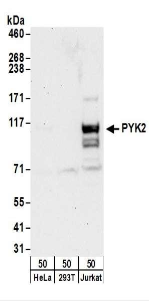 Anti-PYK2