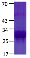NFE2L2 Protein E79K mutant