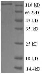 Glycogen phosphorylase, brain form (PYGB), partial, recombinant human