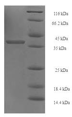 26S proteasome non-ATPase regulatory subunit 10 (PSMD10), human, recombinant