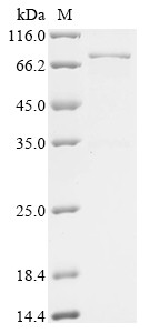 Von Hippel-Lindau disease tumor suppressor (VHL), Biotinylated, human, recombinant