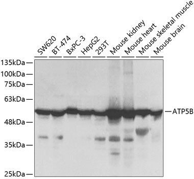 Anti-ATP5B