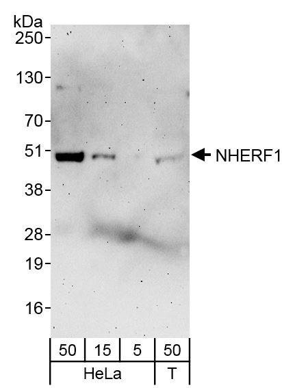 Anti-NHERF1