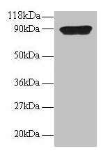 Anti-CXCL5