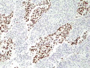 Anti-p53 (human), Rabbit Monoclonal (RM387)