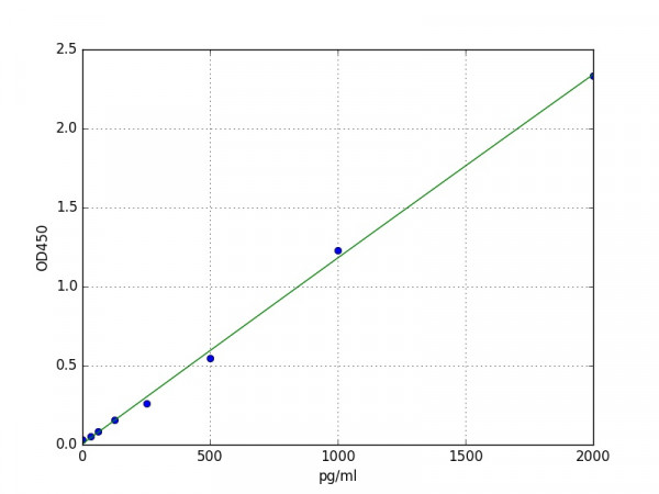 Human SSB(Lupus La protein) ELISA Kit