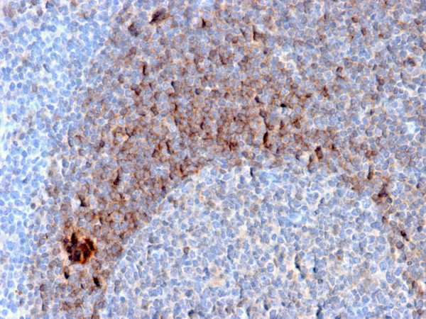 Anti-CD79b (B-Cell Marker), clone B29/123