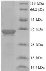 Dysbindin domain-containing protein 2 (DBNDD2), human, recombinant