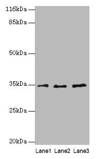 Anti-AZGP1