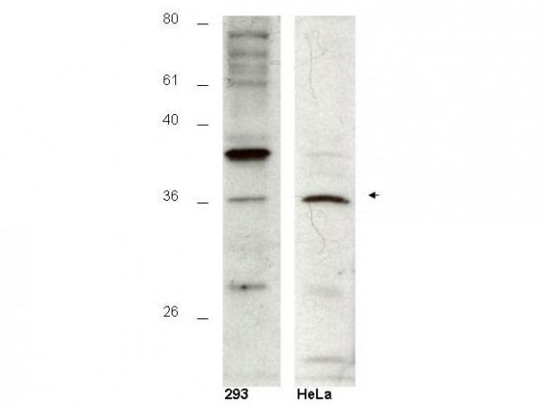 Hus1B Peptide