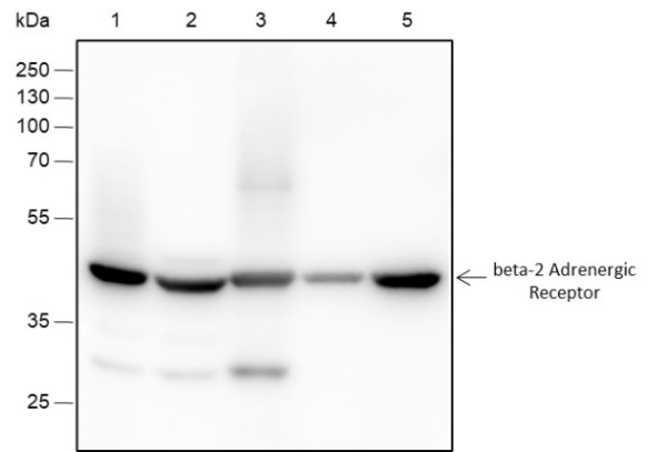 Anti-Recombinant beta-2 Adrenergic Receptor, clone A140
