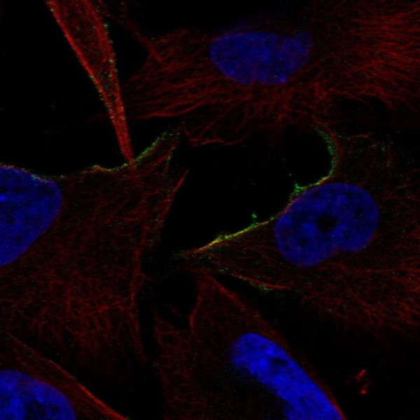 Anti-ADRA1B