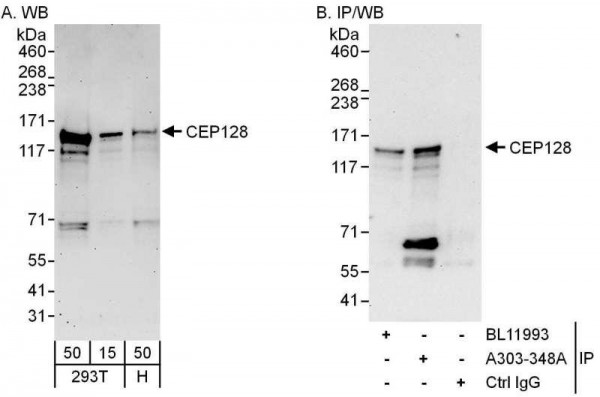Anti-CEP128