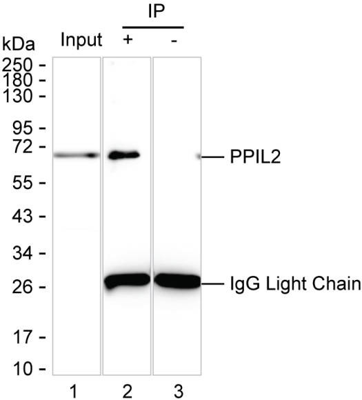 Anti-PPIL2 Magnetic Beads