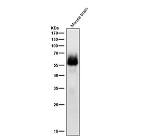 Anti-phospho-Chk2 (Ser33/Ser35) / Checkpoint kinase 2, clone 32C66