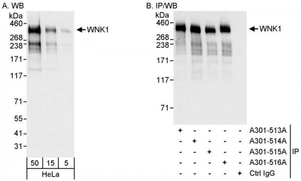 Anti-WNK1