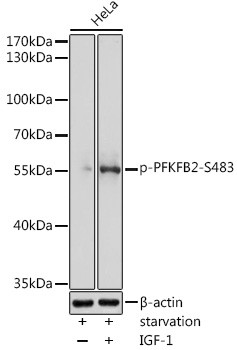 Anti-phospho-PFKFB2 (Ser483)