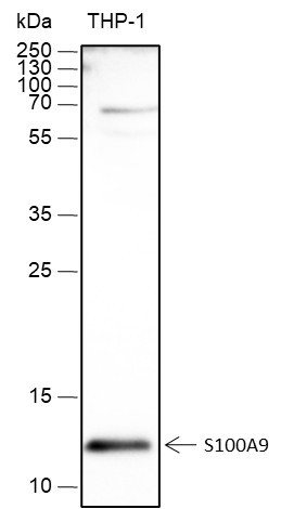 Anti-Recombinant S100A9, clone A450