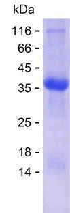RPLP0 (human), recombinant protein