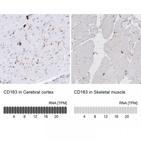 Anti-CD163, clone CL10652