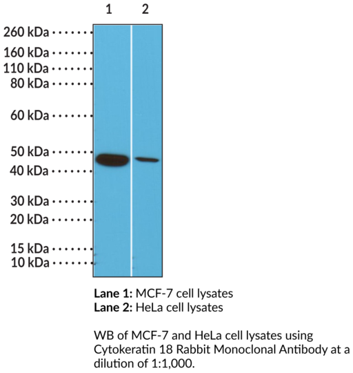 Anti-Cytokeratin 18, clone RM279