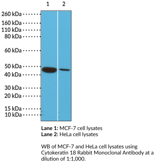 Anti-Cytokeratin 18 Rabbit Monoclonal Antibody (Clone RM279)