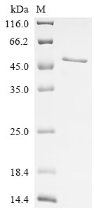 Melanoma-associated antigen 3 (MAGEA3), human, recombinant