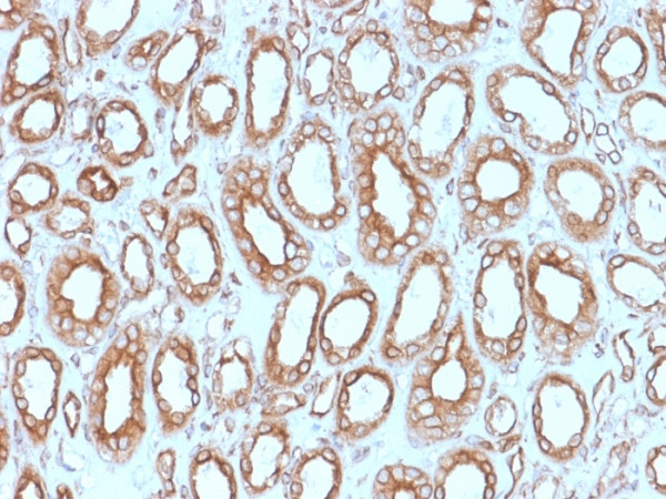 Anti-Calnexin (Endoplasmic Reticulum Marker), clone CANX/1543