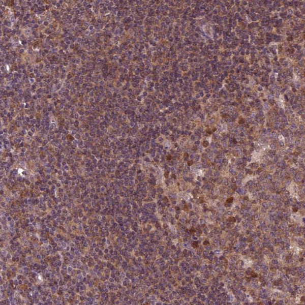 Anti-MDP1