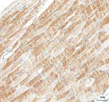 Anti-PI4KB / Phosphatidylinositol 4-kinase beta