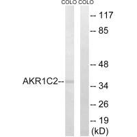 Anti-AKR1C2