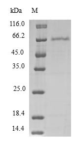 Programmed cell death protein 2-like (PDCD2L), human, recombinant