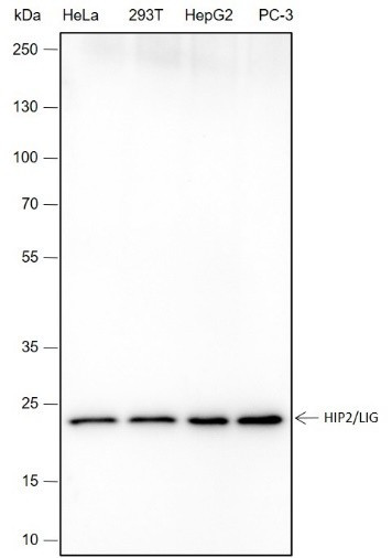 Anti-Recombinant HIP2/LIG, clone A412