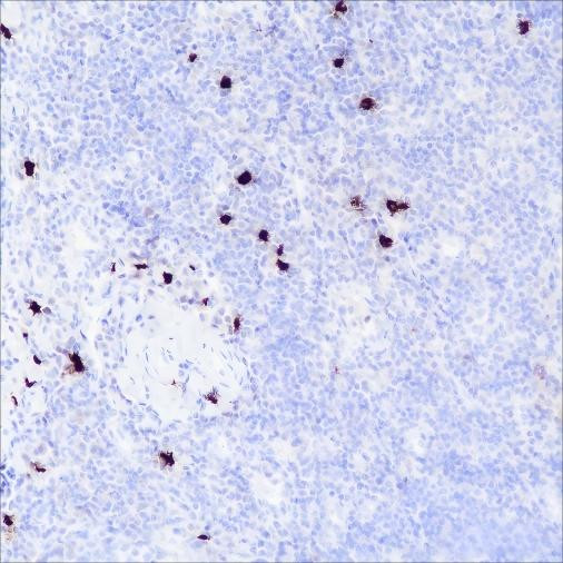 Anti-Recombinant TPSAB1, clone A381