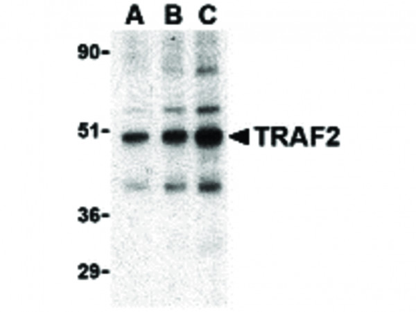 Anti-TRAF2
