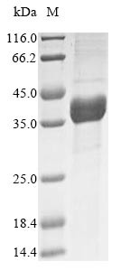 Aspartoacylase (ASPA), human, recombinant