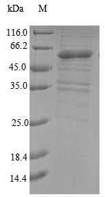 Probable E3 ubiquitin-protein ligase makorin-3 (MKRN3), human, recombinant