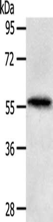 Anti-MATN4