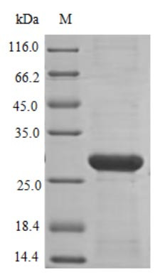 NADPH oxidase 4 (NOX4), partial, human, recombinant