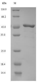Gag polyprotein (gag), partial, Moloney murine leukemia virus, recombinant